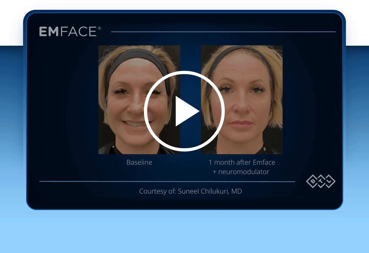 Video IMG